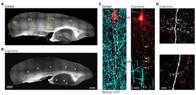 Loss of Saltation and Presynaptic Action Potential Failure in Demyelinated Axons